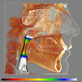 Sleep Apnea Info